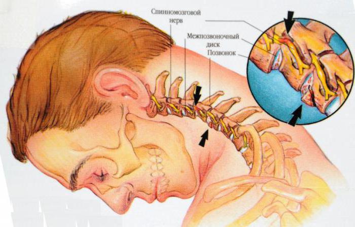 Anatomija: cilvēka kakla struktūra kopumā