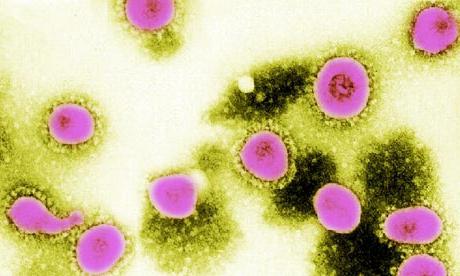 Kādi ir koronavīrusa simptomi cilvēkiem?